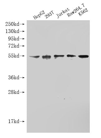 Western Blot Positive WB detected in: SKT38L antibody at 1:1000 Lane 1: HepG2 whole cell lysate Lane 2: 293T whole cell lysate Lane 3: Jurkat whole cell lysate Lane 4: Raw264.7 whole cell lysate Lane 5: K562 whole cell lysate Secondary Goat polycl...