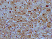 IHC image of CSB-MA908650 diluted at 1:100 and staining in paraffin-embedded human liver tissue performed on a Leica BondTM system. After dewaxing and hydration, antigen retrieval was mediated by high pressure in a citrate buffer (pH 6.0). Section...