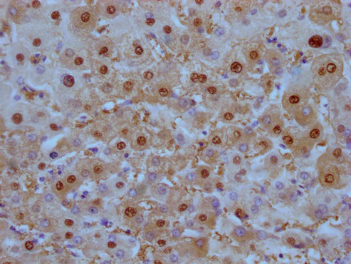 IHC image of CSB-MA908650 diluted at 1:100 and staining in paraffin-embedded human liver tissue performed on a Leica BondTM system. After dewaxing and hydration, antigen retrieval was mediated by high pressure in a citrate buffer (pH 6.0). Section...