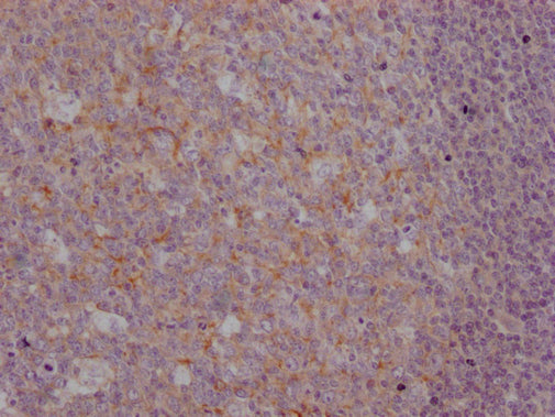 IHC image of CSB-MA916751 diluted at 1:100 and staining in paraffin-embedded human tonsil tissue performed on a Leica BondTM system. After dewaxing and hydration, antigen retrieval was mediated by high pressure in a citrate buffer (pH 6.0). Sectio...