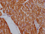 IHC image of CSB-MA923561 diluted at 1:100 and staining in paraffin-embedded human heart tissue performed on a Leica BondTM system. After dewaxing and hydration, antigen retrieval was mediated by high pressure in a citrate buffer (pH 6.0). Section...