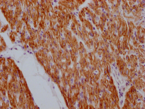 IHC image of CSB-MA923561 diluted at 1:100 and staining in paraffin-embedded human heart tissue performed on a Leica BondTM system. After dewaxing and hydration, antigen retrieval was mediated by high pressure in a citrate buffer (pH 6.0). Section...