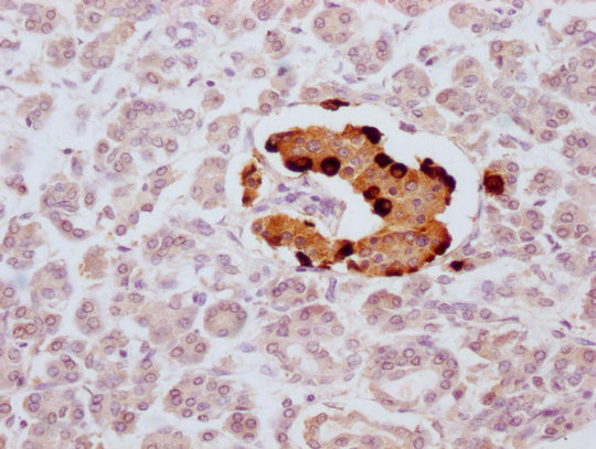 IHC image of CSB-MA935920 diluted at 1:100 and staining in paraffin-embedded human pancreatic tissue performed on a Leica BondTM system. After dewaxing and hydration, antigen retrieval was mediated by high pressure in a citrate buffer (pH 6.0). Se...