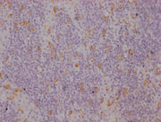 IHC image of CSB-MA942955 diluted at 1:100 and staining in paraffin-embedded human lymph node tissue performed on a Leica BondTM system. After dewaxing and hydration, antigen retrieval was mediated by high pressure in a citrate buffer (pH 6.0). Se...