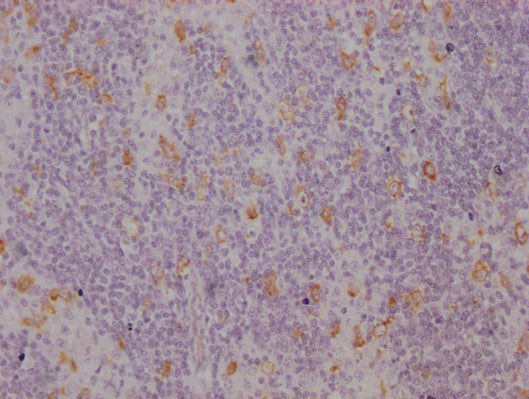 IHC image of CSB-MA942955 diluted at 1:100 and staining in paraffin-embedded human lymph node tissue performed on a Leica BondTM system. After dewaxing and hydration, antigen retrieval was mediated by high pressure in a citrate buffer (pH 6.0). Se...