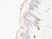 Immunohistochemical analysis of paraffin-embedded Human skin. COL1A1 Antibody was diluted at 1:200.