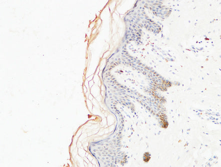 Immunohistochemical analysis of paraffin-embedded Human skin. COL1A1 Antibody was diluted at 1:200.