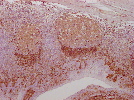 IHC image of CSB-MA961575 diluted at 1:100 and staining in paraffin-embedded human tonsil tissue performed on a Leica BondTM system. After dewaxing and hydration, antigen retrieval was mediated by high pressure in a citrate buffer (pH 6.0). Sectio...