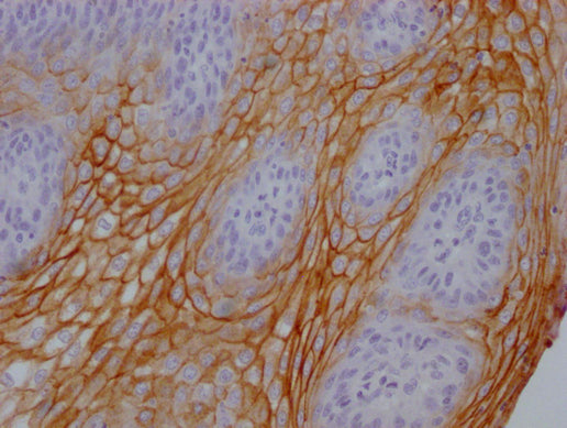 IHC image of CSB-MA995583 diluted at 1:100 and staining in paraffin-embedded human tonsil tissue performed on a Leica BondTM system. After dewaxing and hydration, antigen retrieval was mediated by high pressure in a citrate buffer (pH 6.0). Sectio...