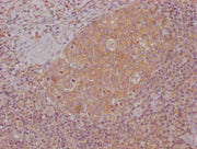 IHC image of CSB-MA996413 diluted at 1:100 and staining in paraffin-embedded human tonsil tissue performed on a Leica BondTM system. After dewaxing and hydration, antigen retrieval was mediated by high pressure in a citrate buffer (pH 6.0). Sectio...