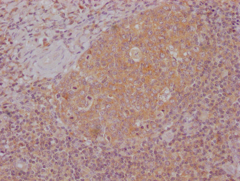 IHC image of CSB-MA996413 diluted at 1:100 and staining in paraffin-embedded human tonsil tissue performed on a Leica BondTM system. After dewaxing and hydration, antigen retrieval was mediated by high pressure in a citrate buffer (pH 6.0). Sectio...