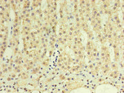 Immunohistochemistry of paraffin-embedded human adrenal gland using CSB-MA999881A0m in 30ug/ml dilute concentrations.