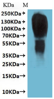 Recombinant Human Type-2 angiotensin II receptor (AGTR2)-VLPs