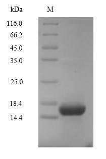 Recombinant Human Complement C5 (C5), partial