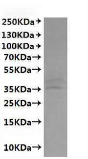 Recombinant Macaca fascicularis C5a anaphylatoxin chemotactic receptor 1 (C5AR1)-VLPs