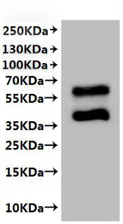 Recombinant Human C-C chemokine receptor type 2 (CCR2)-VLPs