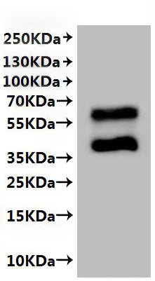 Recombinant Human C-C chemokine receptor type 2 (CCR2)-VLPs