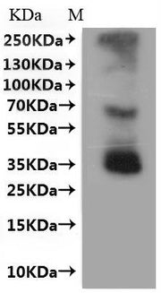 Recombinant Mouse C-C chemokine receptor type 8 (Ccr8)-VLPs