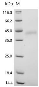 Recombinant Human ADP-ribosyl cyclase/cyclic ADP-ribose hydrolase 1 (CD38), partial (Active)