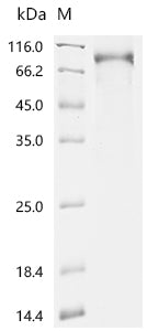 Recombinant Human Membrane cofactor protein (CD46), partial, Biotinylated