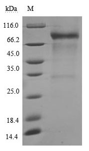 Recombinant Human Membrane cofactor protein (CD46), partial (Active)
