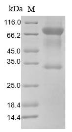 Recombinant Human T-lymphocyte activation antigen CD80 (CD80), partial