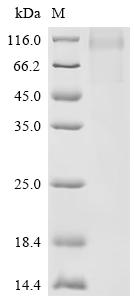 Recombinant Human Carboxypeptidase N subunit 2 (CPN2)