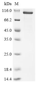 Recombinant Mouse Cartilage acidic protein 1 (Crtac1), partial