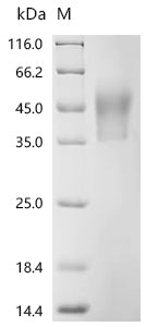 Recombinant Mouse Macrophage colony-stimulating factor 1 (Csf1), partial (Active)