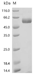 Recombinant Human Dipeptidyl peptidase 1 (CTSC) (Active)