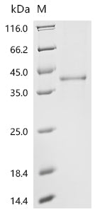 Recombinant Human Cathepsin L2 (CTSV)