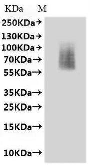 Recombinant Mouse C-X-C chemokine receptor type 3 (Cxcr3)-VLPs