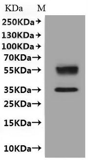 Recombinant Human C-X-C chemokine receptor type 6 (CXCR6)-VLPs