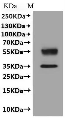 Recombinant Human C-X-C chemokine receptor type 6 (CXCR6)-VLPs