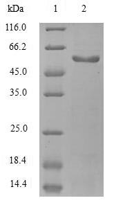Recombinant Mouse EGF-containing fibulin-like extracellular matrix protein 1 (Efemp1)