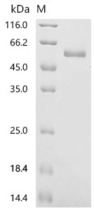 Recombinant Human Ephrin-A5 (EFNA5), partial
