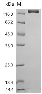 Recombinant Human Ectonucleotide pyrophosphatase/phosphodiesterase family member 3 (ENPP3), partial