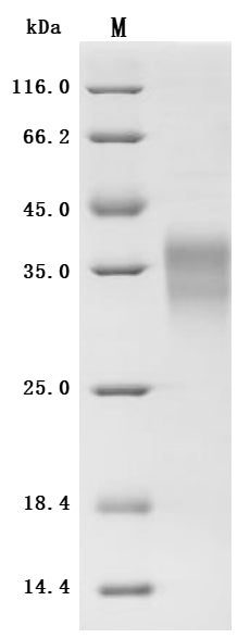 Recombinant Human Erythropoietin (EPO) (Active)