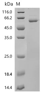 Recombinant Human Erythropoietin receptor (EPOR), partical