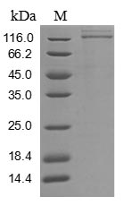 Recombinant Human Vascular endothelial growth factor receptor 1 (FLT1), partial (Active)