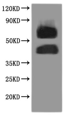 Recombinant Human N-formyl peptide receptor 2 (FPR2)-VLPs