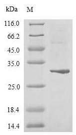 Recombinant Human Zinc finger protein GLI2 (GLI2), partial