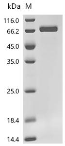 Recombinant Human Protein HEXIM1 (HEXIM1)