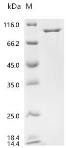 Recombinant Mouse Heat shock protein HSP 90-beta (Hsp90ab1)
