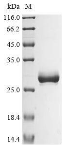 Recombinant Human Basement membrane-specific heparan sulfate proteoglycan core protein (HSPG2), partial