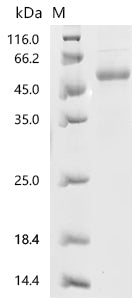 Recombinant Human Interleukin-33 (IL33), partial