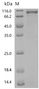 Recombinant Human Interleukin-3 receptor subunit alpha (IL3RA), partial