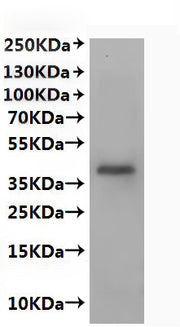 Recombinant Human C-X-C chemokine receptor type 2 (CXCR2)-VLPs