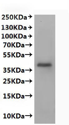 Recombinant Human C-X-C chemokine receptor type 2 (CXCR2)-VLPs