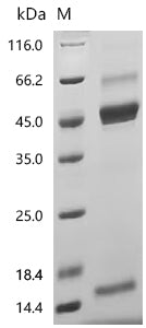 Recombinant Human Inhibin beta A chain (INHBA) (Active)